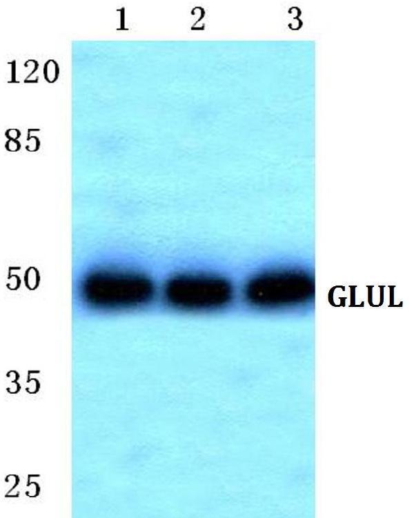 Western blot (WB) analysis of GLUL polyclonal antibody at 1:500 dilution
Lane1:MCF-7 cell lysate
Lane2:Mouse kidney tissue lysate
Lane3:H9C2 cell lysate