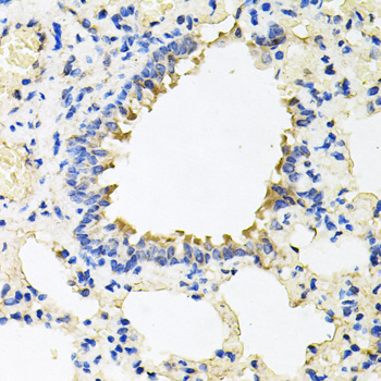 Immunohistochemistry of paraffin-embedded mouse skin using CALU antibody at dilution of 1:100 (x40 lens)
