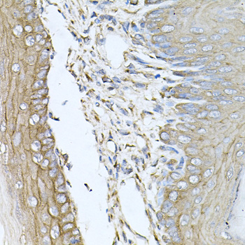 Immunohistochemistry of paraffin-embedded rat lung using CALU antibody at dilution of 1:100 (x40 lens)