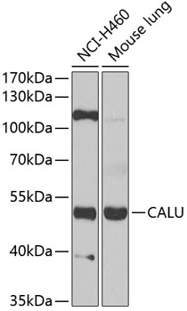 Western blot analysis of extracts of various cells, using CALU antibody