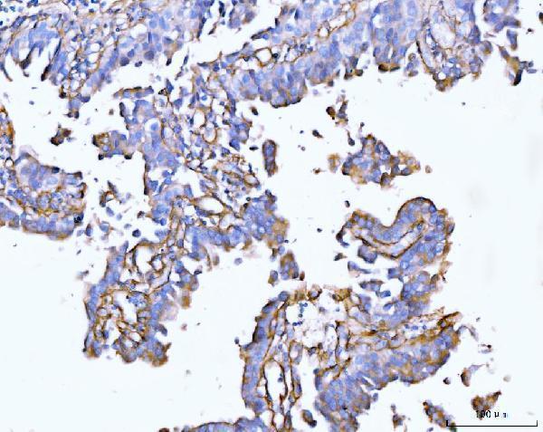  IHC analysis of Collagen VI/COL6A2 using anti-Collagen VI/COL6A2 antibody (A03194-2)