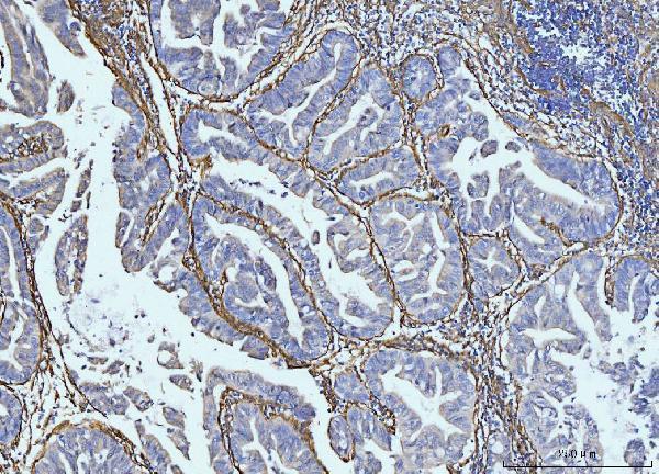  IHC analysis of Collagen VI/COL6A2 using anti-Collagen VI/COL6A2 antibody (A03194-2)