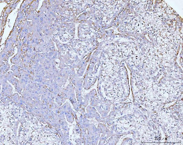a03194 2 col6a2 primary antibodies ihc testing 4