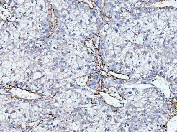 a03194 2 col6a2 primary antibodies ihc testing 5