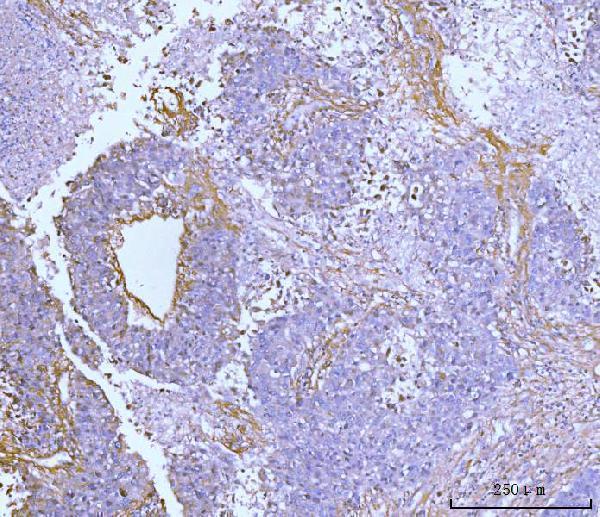 a03194 2 col6a2 primary antibodies ihc testing 6