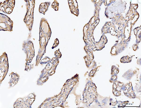 a03194 2 col6a2 primary antibodies ihc testing 8