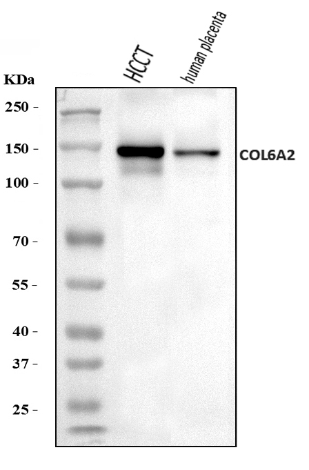  Western blot analysis of Collagen VI/COL6A2 using anti-Collagen VI/COL6A2 antibody (A03194-2)