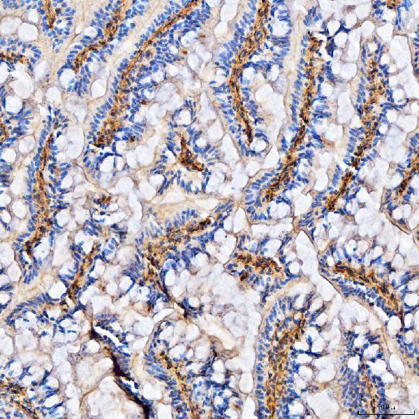  IHC analysis of Col6a2 using anti-Col6a2 antibody (A03194-3)