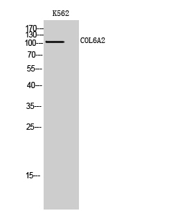 Western Blot (WB) analysis of K562 cells using COL6A2 Polyclonal antibody