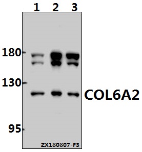 Western blot (WB) analysis of COL6A2 (Y711) pAb at 1:1000 dilution
Lane1:U-87MG whole cell lysate(40ug)
Lane2:PC3 whole cell lysate(40ug)
Lane3:MCF-7 whole cell lysate(40ug)