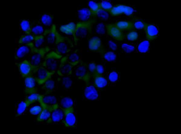 a03195 1 rictor primary antibodies icc testing 4