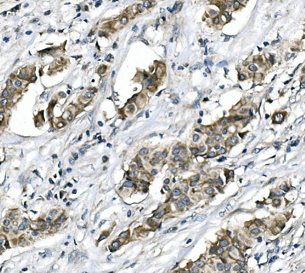a03195 1 rictor primary antibodies ihc testing 2