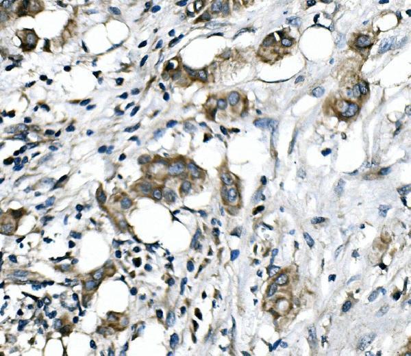 a03195 1 rictor primary antibodies ihc testing 3