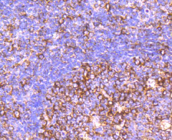 Immunohistochemical analysis of paraffin-embedded human tonsil tissue using anti-CD39 antibody