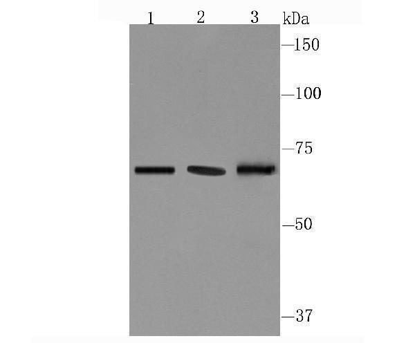 Western blot analysis of CD39 on different cell lysate using anti-CD39 antibody at 1/1,000 dilution