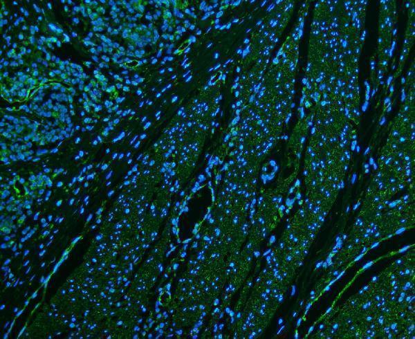 a03196 3 entpd1 primary antibodies if testing 7