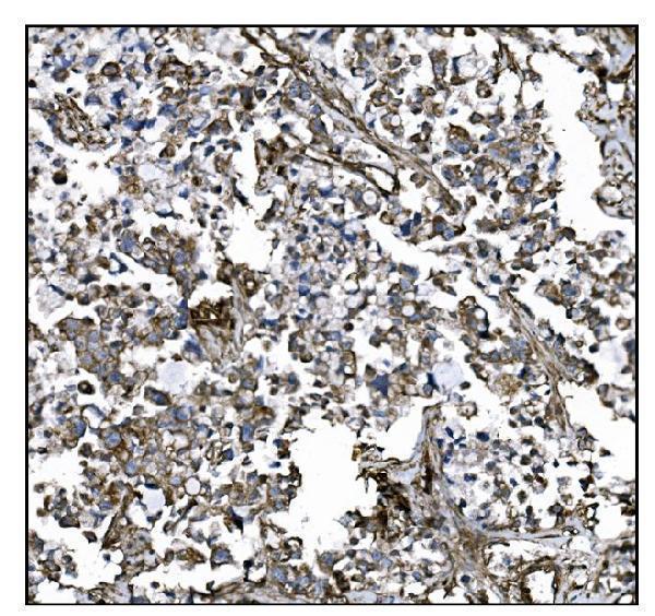  IHC analysis of CD39/ENTPD1 using anti-CD39/ENTPD1 antibody (A03196-3)