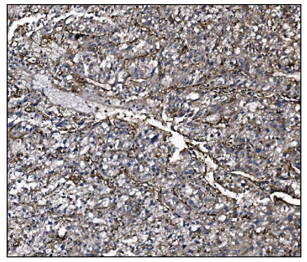  IHC analysis of CD39/ENTPD1 using anti-CD39/ENTPD1 antibody (A03196-3)