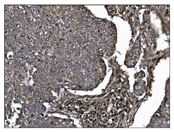 a03196 3 entpd1 primary antibodies ihc testing 4