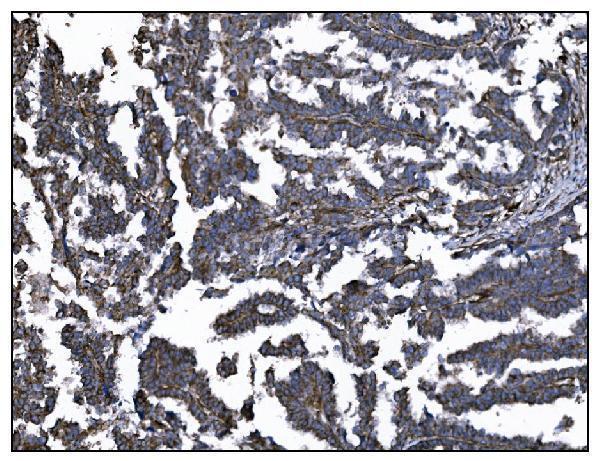 a03196 3 entpd1 primary antibodies ihc testing 5