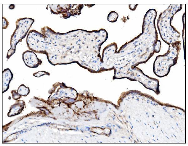 a03196 3 entpd1 primary antibodies ihc testing 6