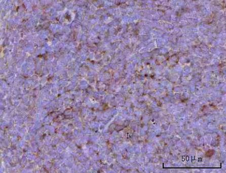  IHC analysis of CD39/Entpd1 using anti-CD39/Entpd1 antibody (A03196-4)