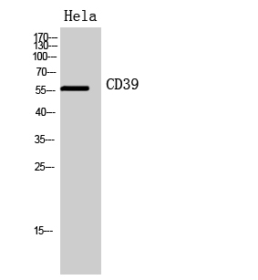 Western Blot analysis of Hela cells using CD39 Polyclonal Antibody