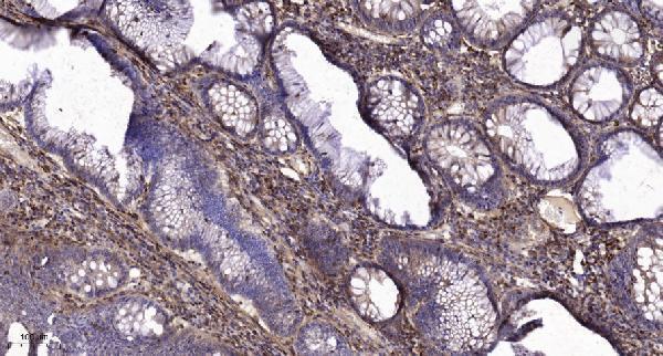 a03197 1 ceacam6 primary antibodies ihc testing 1