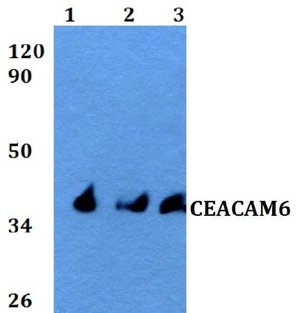 a03197 ceacam6 primary antiboties wb testing 1