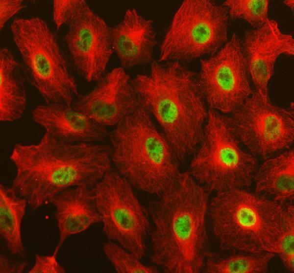IF analysis of RAI1 using anti-RAI1 antibody (A03198) and anti-Beta Tubulin antibody (M01857-3)