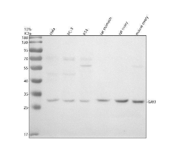 Western blot analysis of GJB3 using anti-GJB3 antibody (A03199-1)