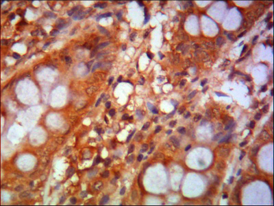 Immunohistochemistry analysis of paraffin-embedded human colon using Mi2-α Monoclonal Antibody