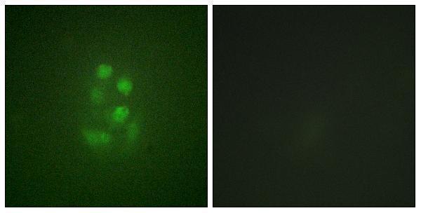 Immunofluorescence analysis of A549 cells, using KIF2C (Phospho-Ser95) Antibody