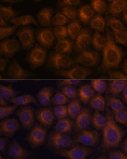 a03204 vav3 primary antiboties if testing 2