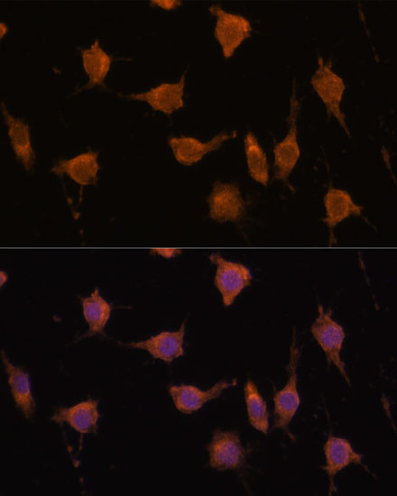 a03204 vav3 primary antiboties if testing 3