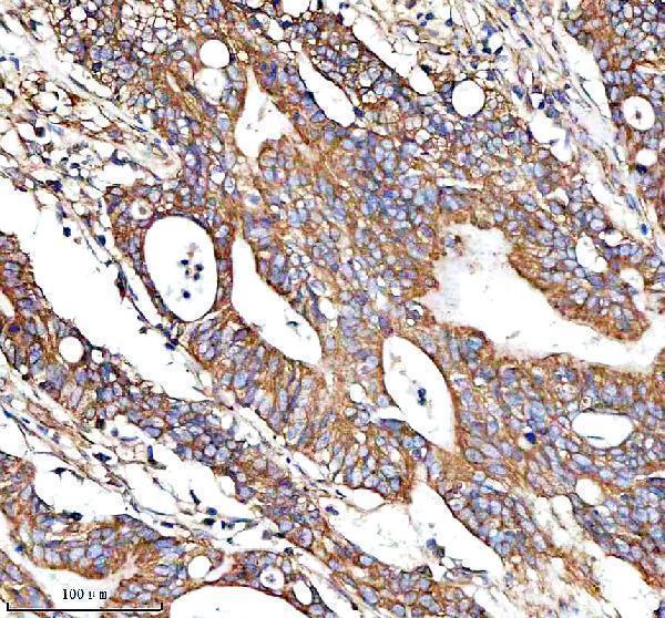  IHC analysis of Desmocollin 2/DSC2 using anti-Desmocollin 2/DSC2 antibody (A03205-2)