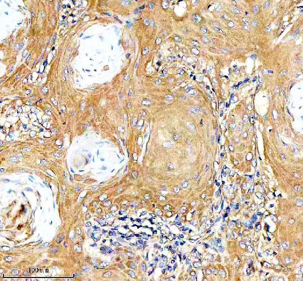  IHC analysis of Desmocollin 2/DSC2 using anti-Desmocollin 2/DSC2 antibody (A03205-2)