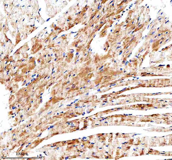 a03205 2 desmocollin 2 dsc2 primary antibodies ihc testing 4