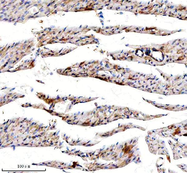 a03205 2 desmocollin 2 dsc2 primary antibodies ihc testing 5