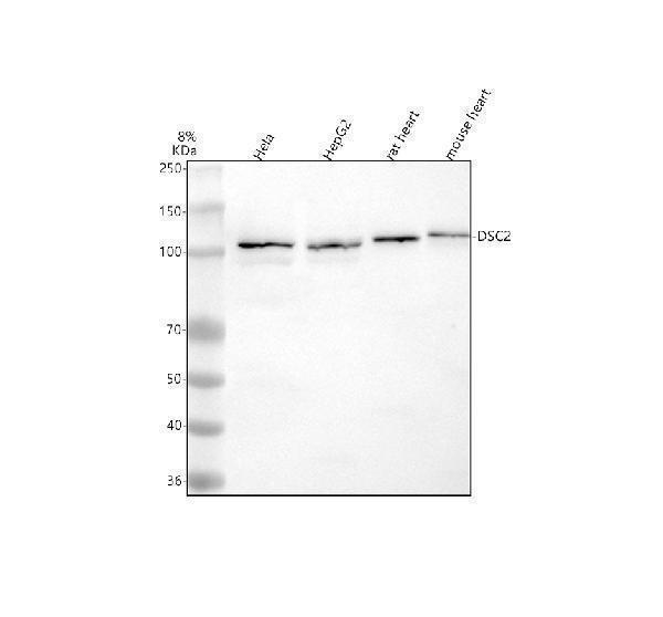  Western blot analysis of Desmocollin 2/DSC2 using anti-Desmocollin 2/DSC2 antibody (A03205-2)