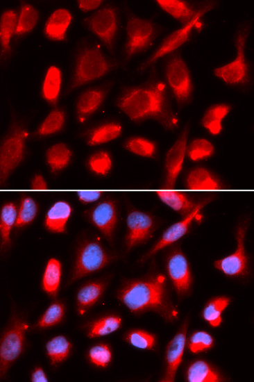 Immunofluorescence analysis of U2OS cells, using UROD polyclonal antibody
