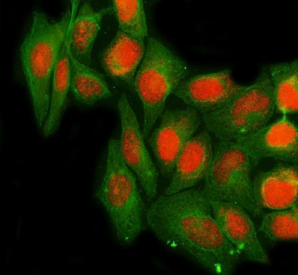  IF analysis of NTHL1 using anti-NTHL1 antibody (A03207-2) and anti-Beta Tubulin antibody (M01857-3)