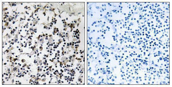 a03210 clic4 primary antibodies ihc testing 1