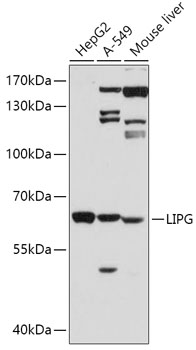 Western blot analysis of extracts of various cell lines, using LIPG antibody  at 1:500 dilution