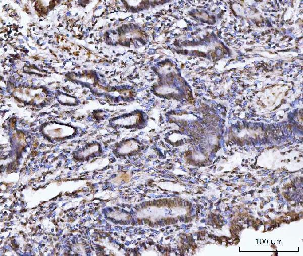  IHC analysis of UBA6 using anti-UBA6 antibody (A03213-2)