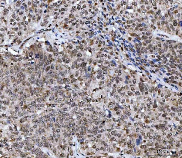  IHC analysis of UBA6 using anti-UBA6 antibody (A03213-2)