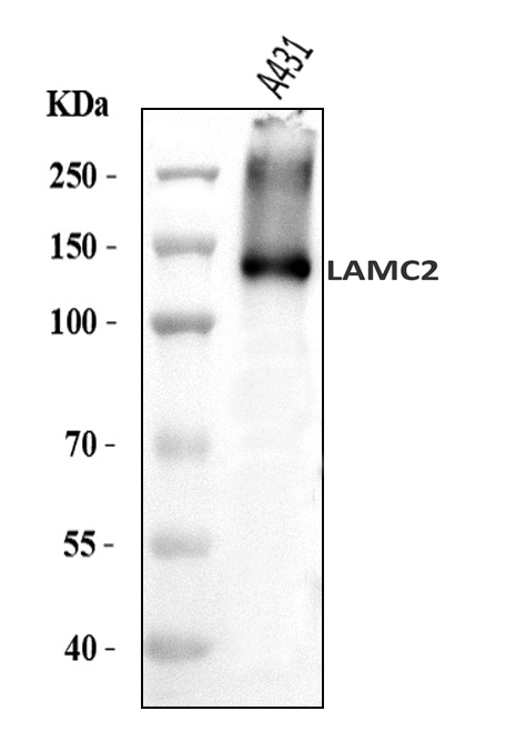  Western blot analysis of LAMC2 using anti-LAMC2 antibody (A03214)