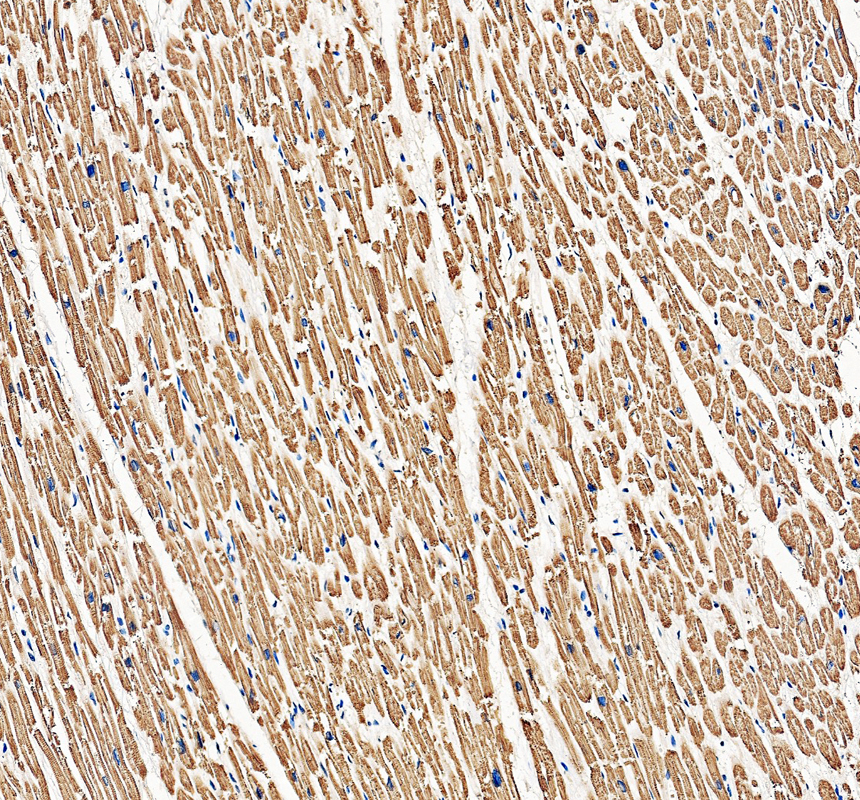 IHC analysis of MYL2 using anti-MYL2 antibody (A03215-3)
