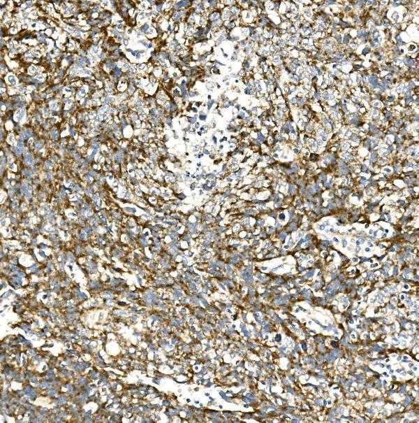 a03216 1 vps4a primary antibodies ihc testing 2
