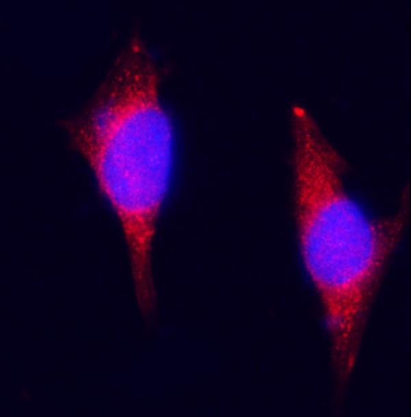  IF analysis of ZAC/Plagl1 using anti-ZAC/Plagl1 antibody (A03220-2)
